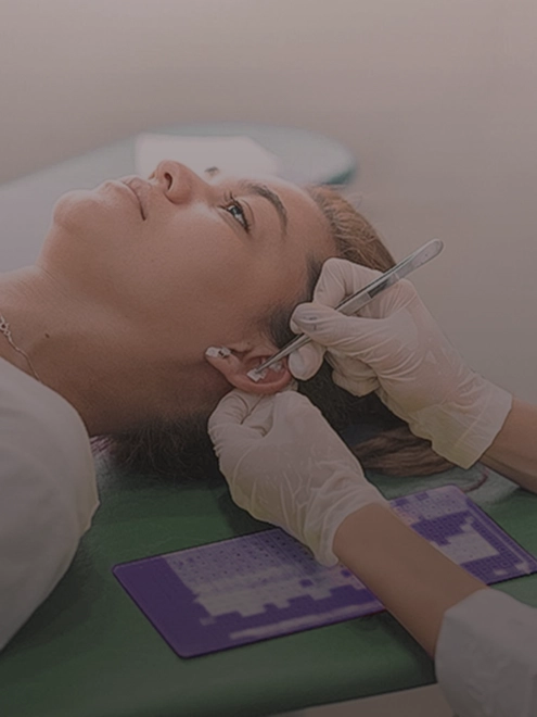 Auriculoterapia como Prática de Cuidado Integral